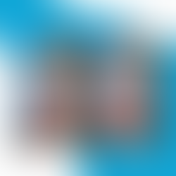 Jawline Threadlift results