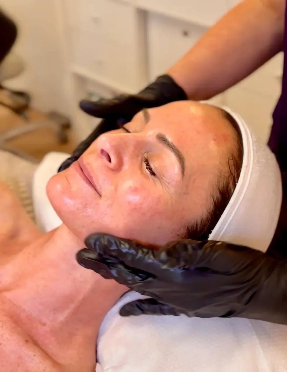 Collagen Banking Explained: Natural Skin Rejuvenation for Lasting Youth