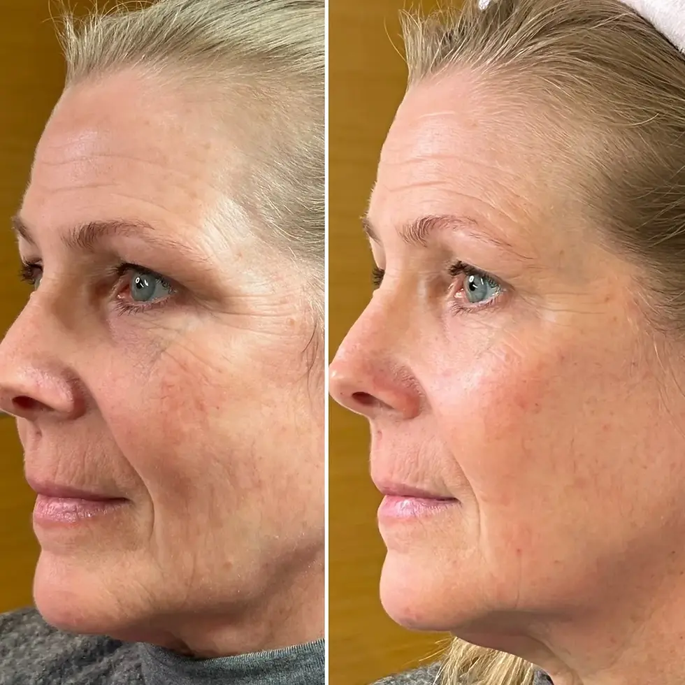 How to Look Younger Without Having Work Done: Enhancing Your Natural Glow