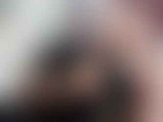 Viruela del mono: murió el joven cordobés que contrajo la enfermedad en México