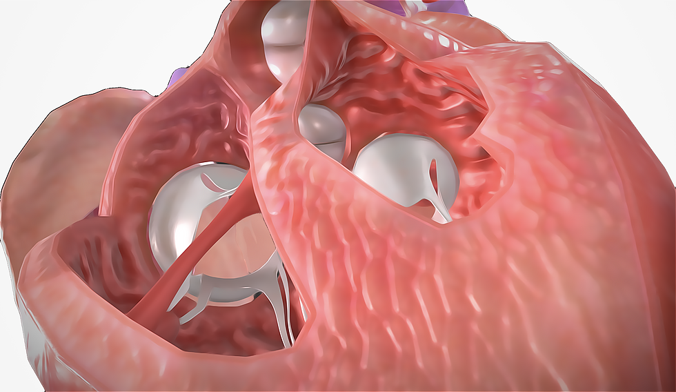 Herzmedizin Perspektive Herzscheidewand (Septum)