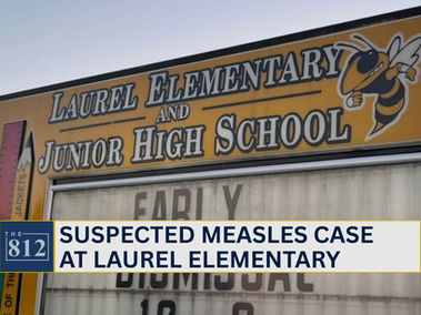 Suspected measles case reported at Laurel Elementary