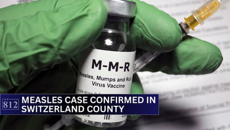 Measles case confirmed in Switzerland County 