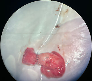 Dr Daniel Sucupira Reversao de vasectomia.jpg