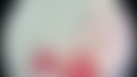 Reversão de Vasectomia: como funciona, chances de sucesso e quando vale mais que FIV/ICSI