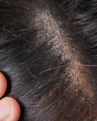 HAIR SCENT POTENZA CENTRO TRICOLOGICO SPECIALIZZATO