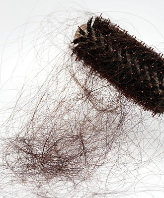 caduta capelli centro tricologico a Potenza