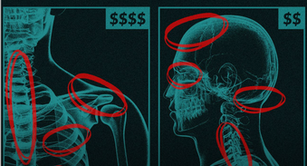 Medicaid paid $50 Billion for Diseases that Didn't Exist