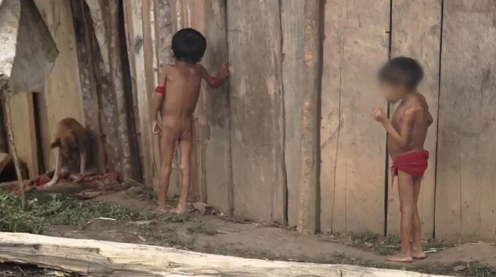 Desnutrição atinge cerca de 50% de crianças Yanomami de até 5 anos monitoradas pelo SUS