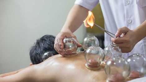 Traditional Fire Cupping.jpg