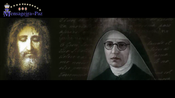 Medalha da Sagrada Face