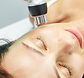 Radio-Frequency-treatment.jpeg