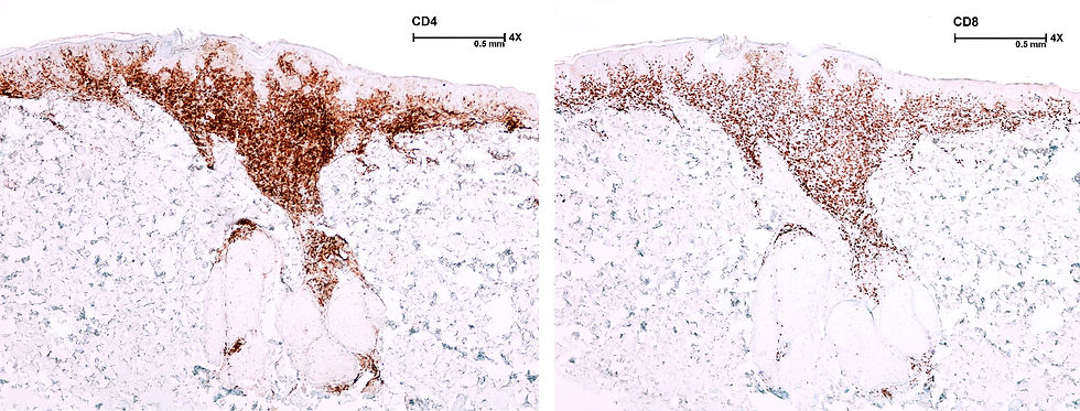 F16 CD4/CD8