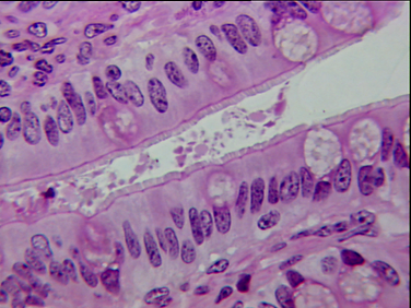 jejunum brush border 40x copy.png