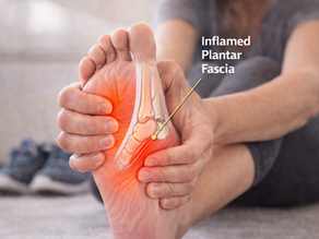 Close-up view of a person holding their heel in pain