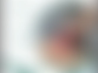 TRATAMENTO COM LASER