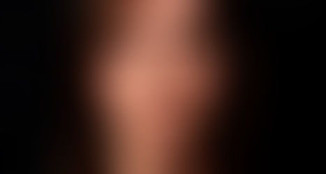 Derealizzazione: Sogno o Realtà?