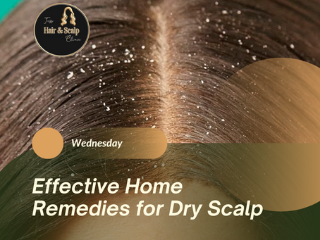 Effective Home Remedies for Dry Scalp