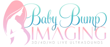 Baby%20Bump%20Imaging%20N%20(2)_edited.p