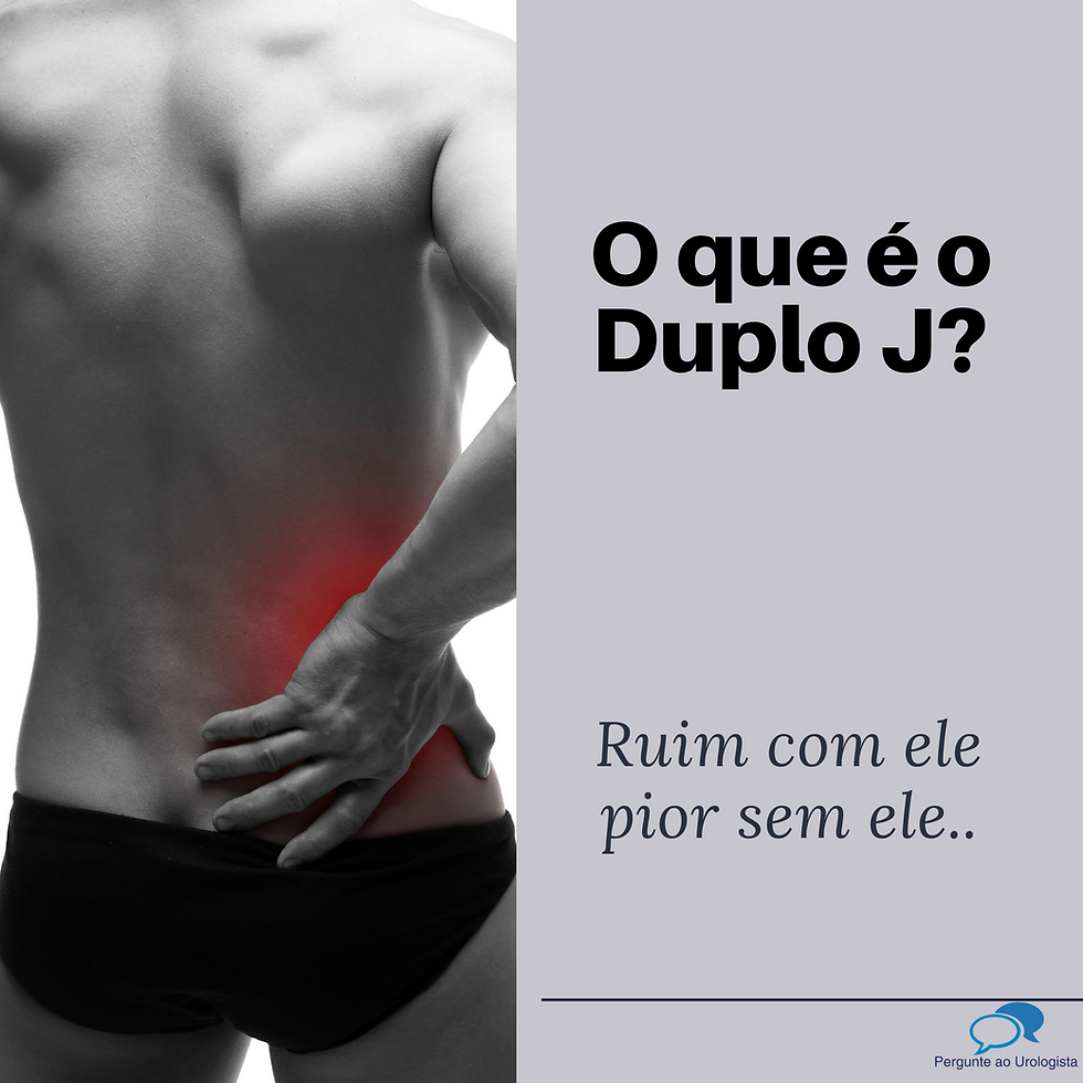 O que é Duplo J ? Ruim com ele, pior sem ele.