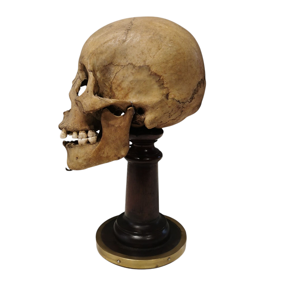 Thumbnail: Genuine Antique Human Skull