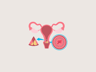 colposcopy
