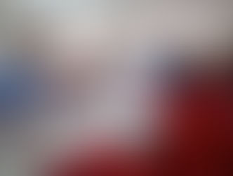 72 की उम्र, कई बीमारियां...निर्मल आश्रम अस्पताल में महिला की जटिल सर्जरी सफल