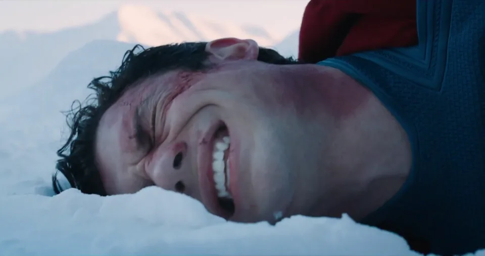 Superman souffre