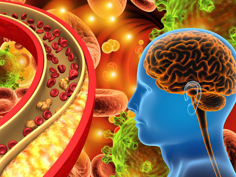 Verursachen Protein-Ablagerungen in Blutgefäßen eine Demenz ?