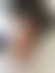 Geen eerlijke voorlichting prenataal testen: gevolgen voor kinderen met trisomie 13 en 18 moet verteld worden.