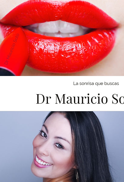 porcelain veneers colombia