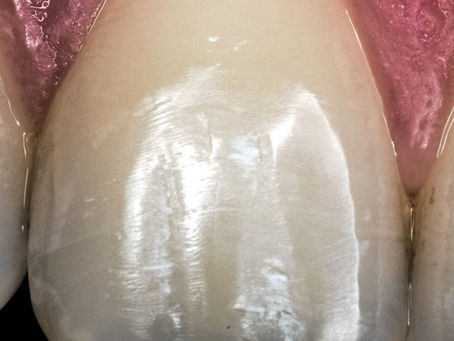 Fotografia Odontológica