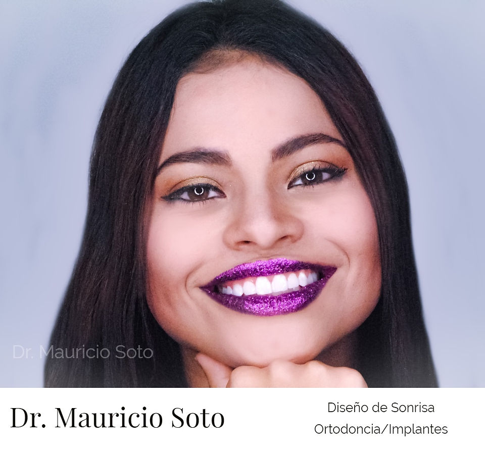 My Post (50)