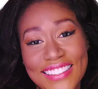 porcelain veneers colombia (4).webp