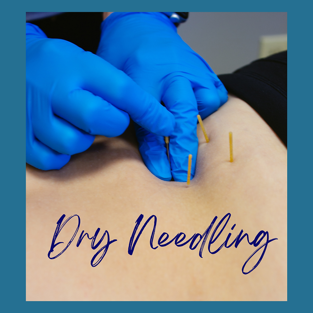 On Pins and Needles? All About Dry Needling!