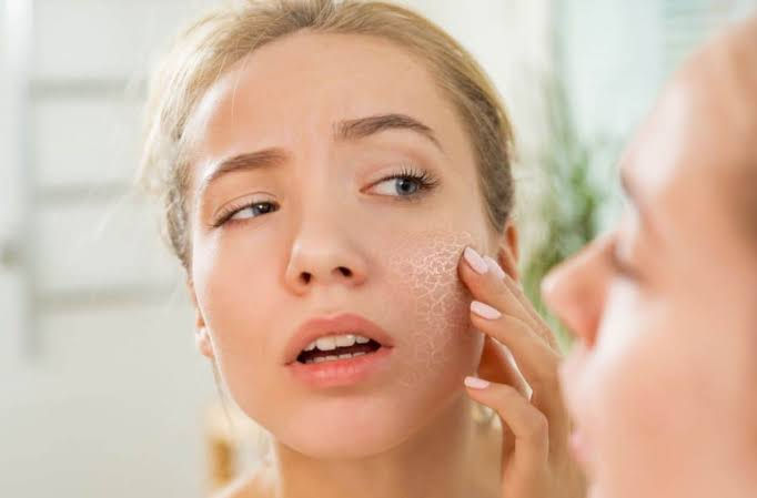female with impaired skin barrier