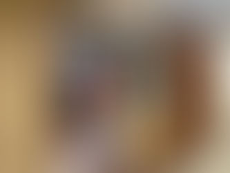 Abdominal Paracentesis #6 (July 31, 2024)