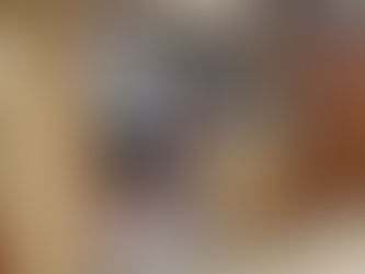 Abdominal Paracentesis #3 (June 24, 2024)