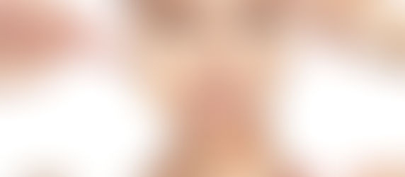 How Well Do You Know Your Skin: Importance of A Skin Analysis
