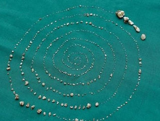 Bocah 7 Tahun di India Punya 526 Gigi di Gusi, Kok Bisa?