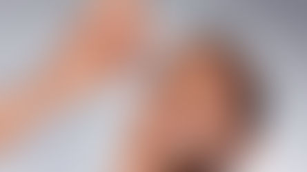 Pingar colírios sem recomendação médica pode causar sérios problemas à saúde ocular!