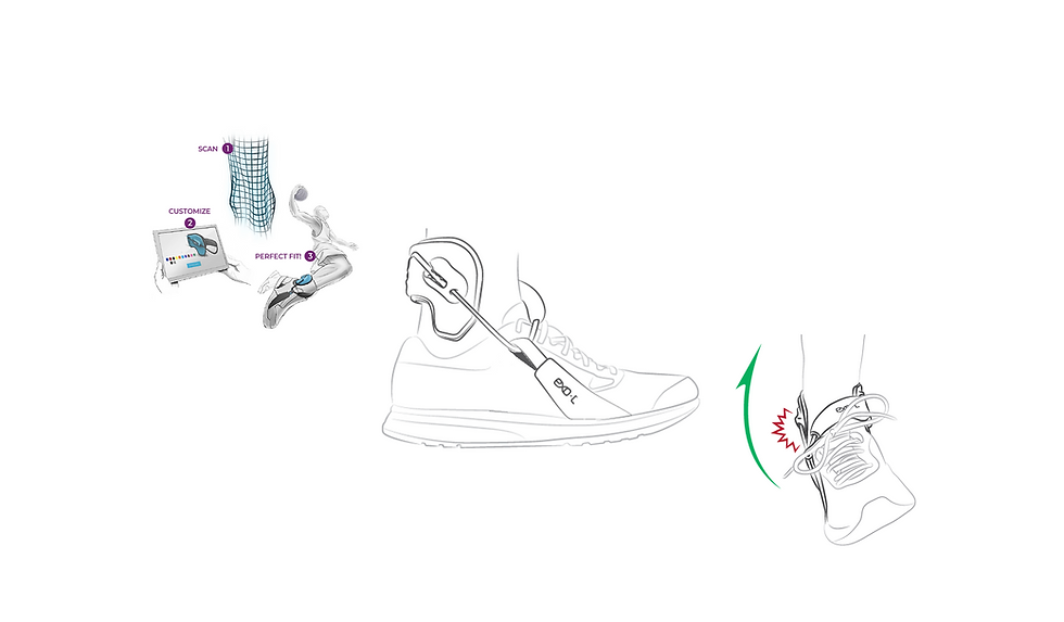 Thumbnail: EXO-L ‘BRACE’ (left & right braces)