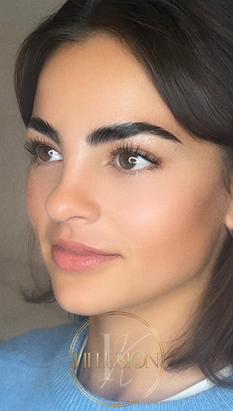 Browlift, browtox