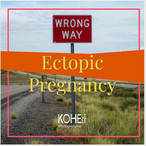 Ectopic pregnancy