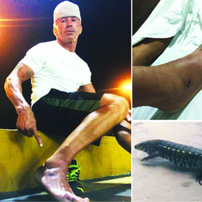 Lagarto ataca banhista na praia