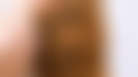 can a dry scalp cause hair loss