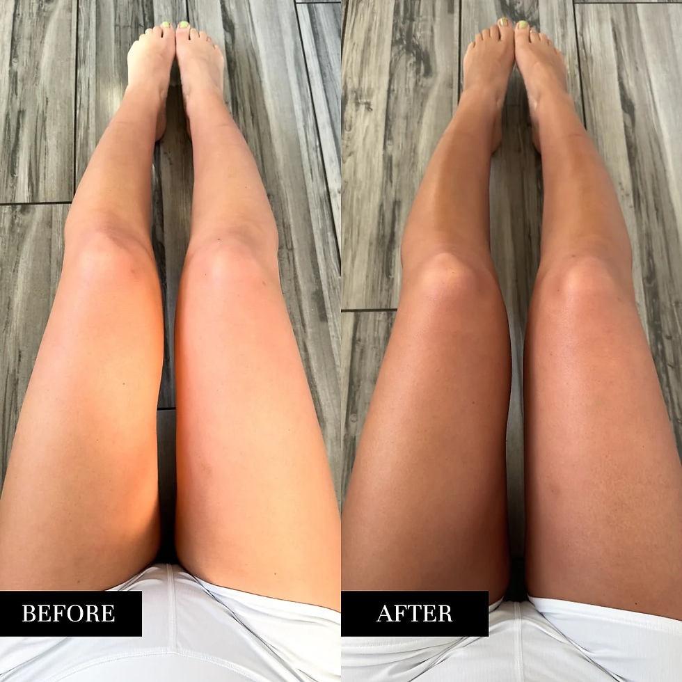 Sunless Tanning (Lotions & Mousses)