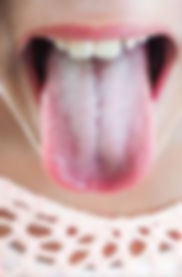 ree