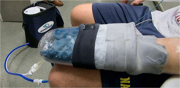 Stanford glove prototype