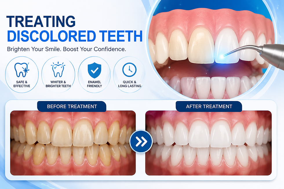 Discolored teeth treatment in kompally